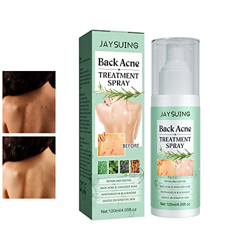 Back Acne Treatment Spray