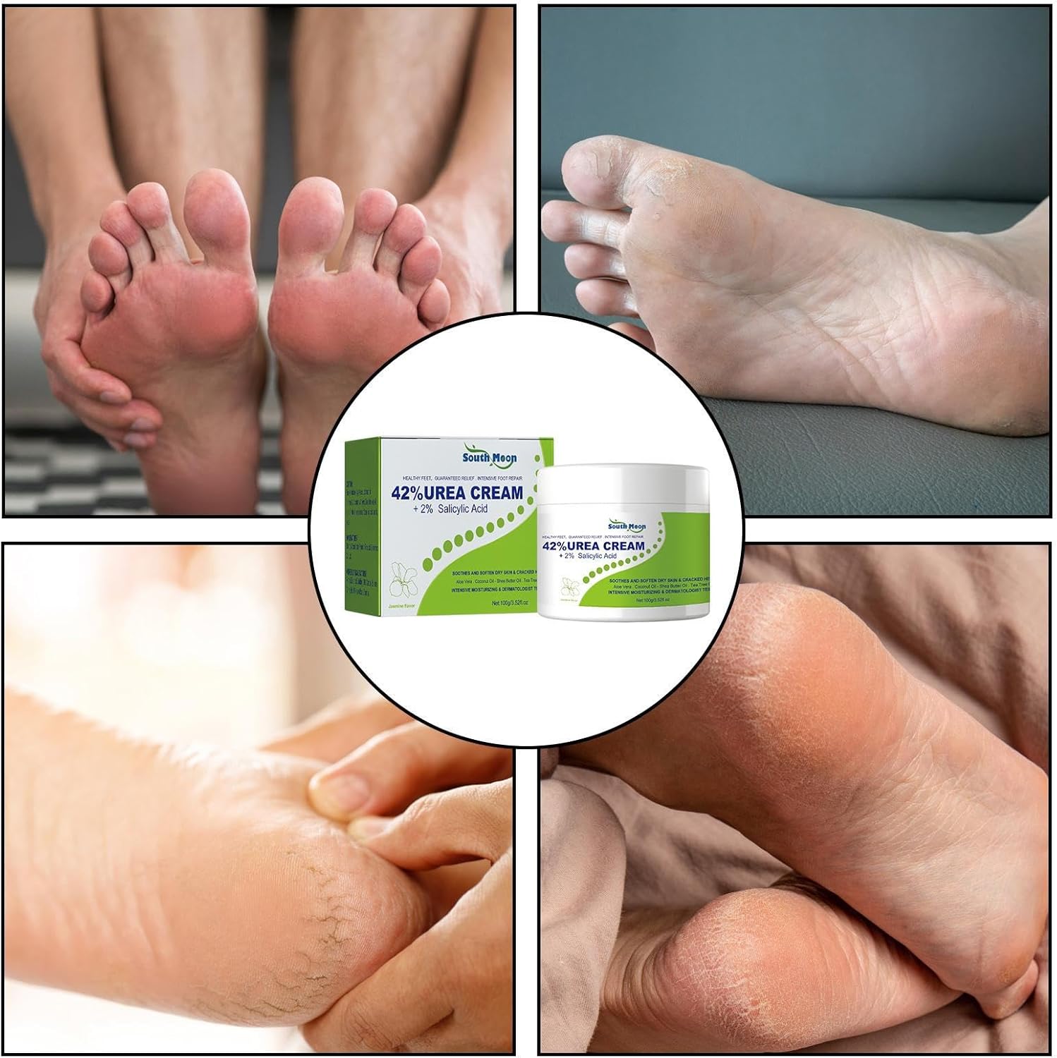 South Moon - 42% Urea Cream + 2% Salicylic Acid